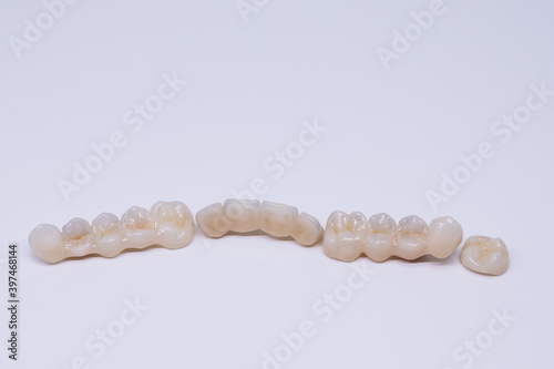 Beautiful ceramic teeth. Porcelain crown and bridge. Dental ceramic bridge in wite background. Metal free ceramic dental crowns.