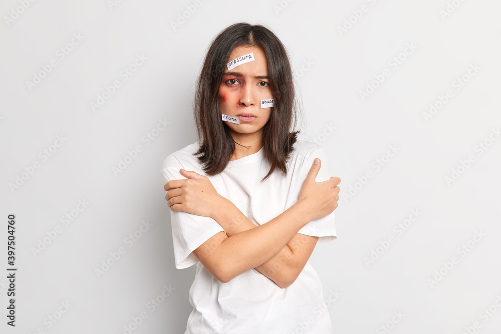 Poor Asian woman stands in defensive pose embraces herself being afraid of cruelty has bruise under eye after beaten by aggressive man faces physical abuse cannot cope with violence in her family Poor Asian woman stands in defensive pose embraces herself being afraid of cruelty has bruise under eye after beaten by aggressive man faces physical abuse cannot cope with violence in her family