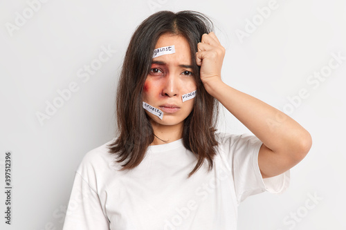Frustrated young woman has awful moment of life bruises on face after being hurt by cruel person becomes victim of violence or racist attack stands offended against white background. Help me © wayhome.studio 