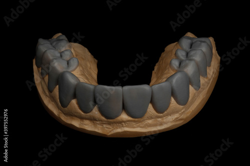 teeth wax-up design