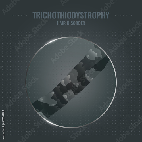 Trichothiodystrophy damaged hair surface under microscope. Hair follicle brittle condition closeup trichoscopy vector. Problem of fragility and breakage. Trichology medical concept.