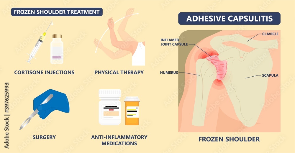 Frozen shoulder adhesive capsulitis surgery stiff crush ribs bone lift
