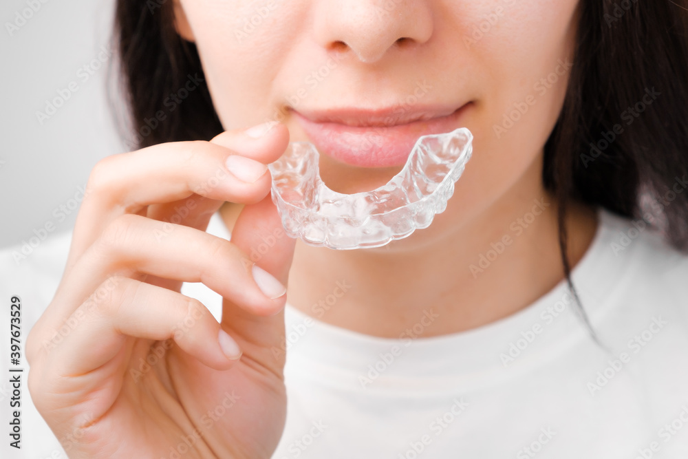 Close up of a young woman adjusting transparent aligners. Taking care of teeth. Orthodontic treatment for straightening and whitening teeth. Close up of a young woman adjusting transparent aligners. Taking care of teeth. Orthodontic treatment for straightening and whitening teeth.