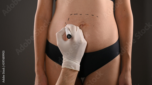 plastic surgery of the female abdomen