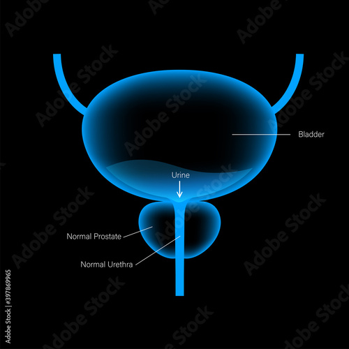 BPH info concept