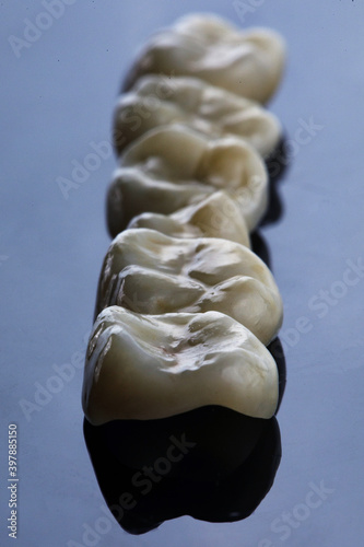 excellent composition of dental crowns-inlays on a light background