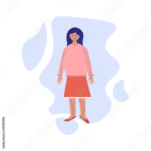 Pregnancy symptoms and problems concept. Young pregnant women suffering from varicose veins. Problem with health, feeling bad flat illustration