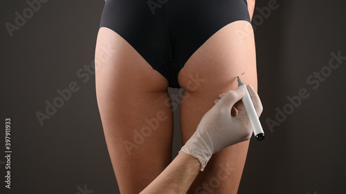 Closeup view of female buttocks marked for plastic operation, on gray background