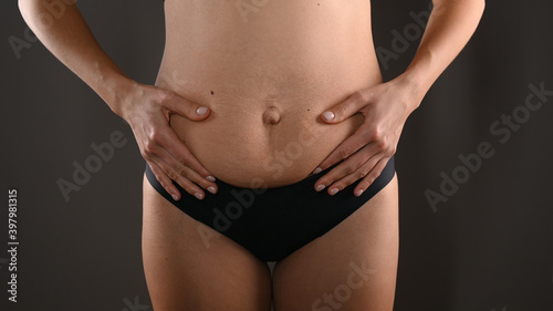 The young woman shows changes in her figure after childbirth, diastasis, flabby saggy belly. Concept of body care, weight loss
