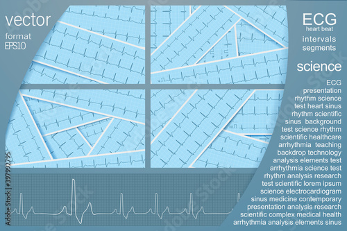 ECG vector background set with several realistic cardiograms