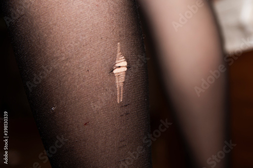a young girl's nylon tights were torn
