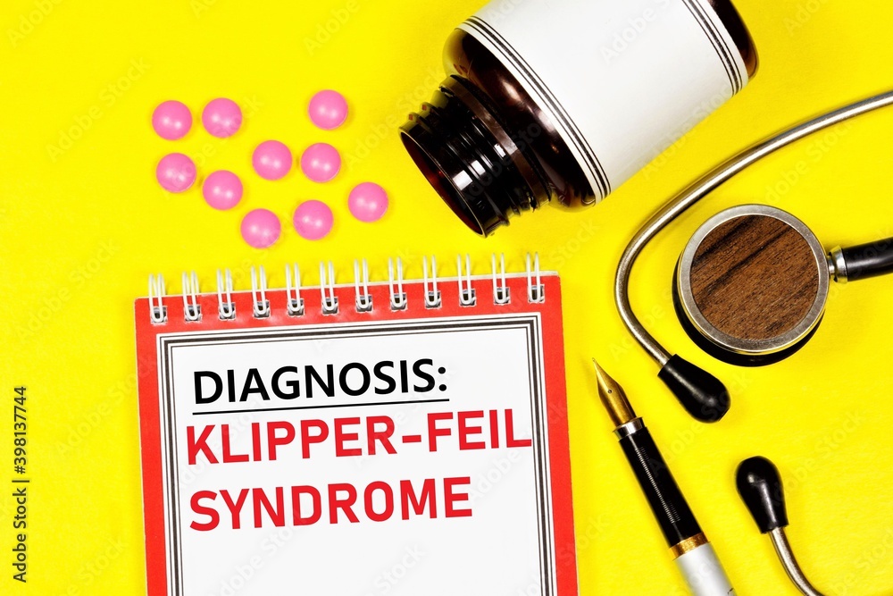 Klipper-feil sindrome. Text label for a medical diagnosis. Malformation