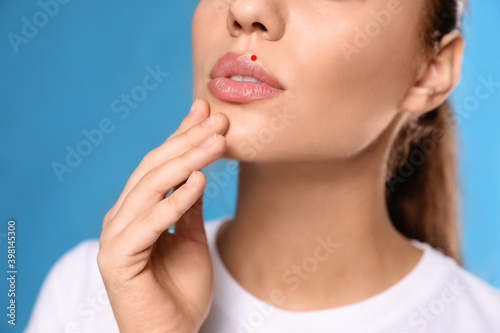 Woman with herpes on lips against light blue background, closeup