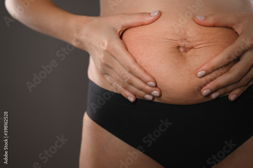 Close-up of female hands squeezing excess fat isolate on gray background. Woman showing stretch marks and fat belly