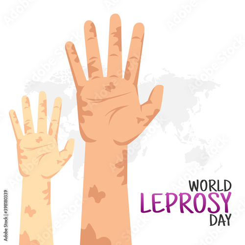 Obraz na plátne vector graphic of world leprosy day good for world leprosy day celebration