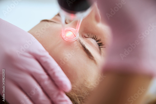 Caucasian female getting a laser skin treatment
