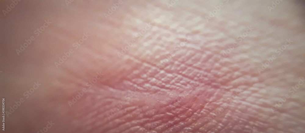 skin of human hand.Medicine and dermatology concept. Details of human skin. Macro human skin pattern skin of human hand.Medicine and dermatology concept. Details of human skin. Macro human skin pattern