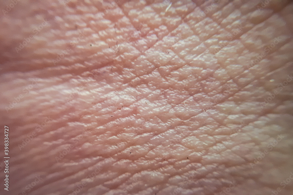skin of human hand.Medicine and dermatology concept. Details of human skin. Macro human skin pattern skin of human hand.Medicine and dermatology concept. Details of human skin. Macro human skin pattern