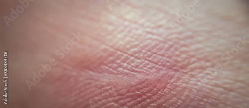 skin of human hand.Medicine and dermatology concept. Details of human skin. Macro human skin pattern