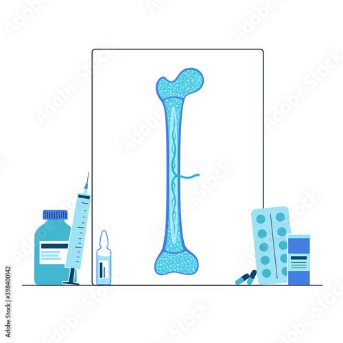 Bones template concept