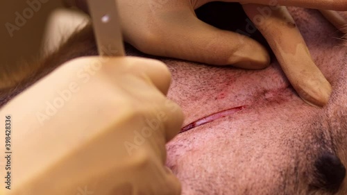 The veterinarian makes an incision on the dog's skin. The first stage of surgery.