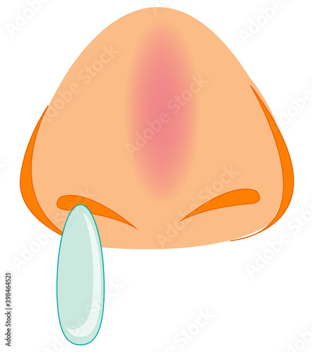 Sick nose of the person type frontal