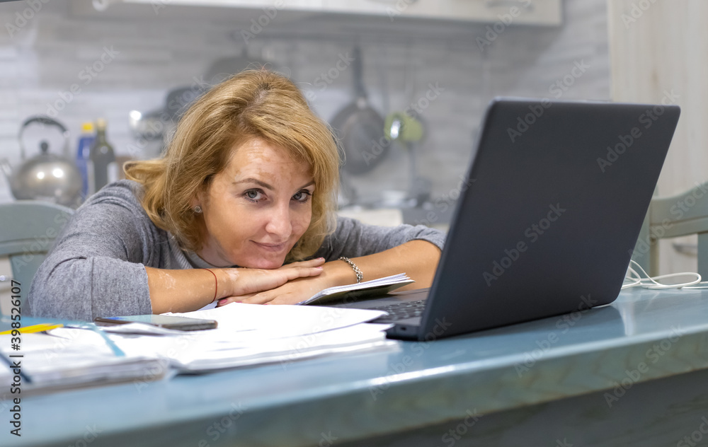 Mature woman suffering from vitiligo is working on computer from home. Working at a distance, away from the office. With earphones she listens to music for relaxation Mature woman suffering from vitiligo is working on computer from home. Working at a distance, away from the office. With earphones she listens to music for relaxation