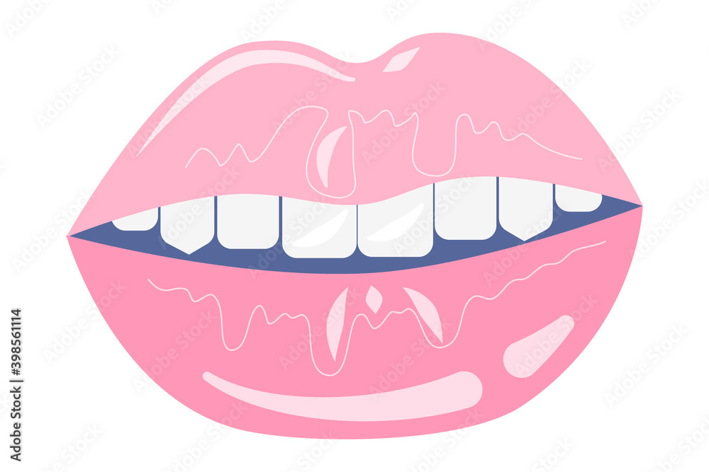 Lips isolated on a white background. Icon for Valentine's Day. Parted pink lips with teeth. Vector illustration.. Lips isolated on a white background. Icon for Valentine's Day. Parted pink lips with teeth. Vector illustration..