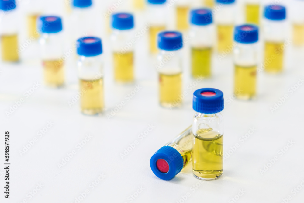 Test tubes with urine sample for HPLC analysis in the laboratory. Test tubes with urine sample for HPLC analysis in the laboratory.