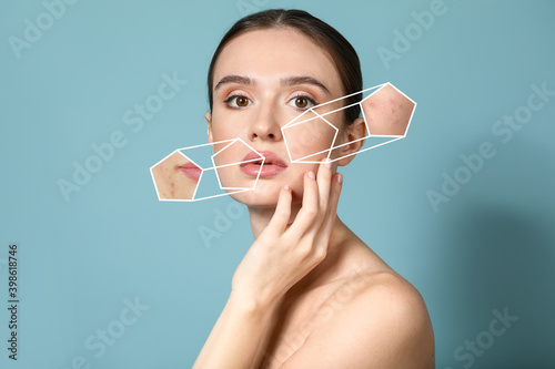 Young woman with problem sk...