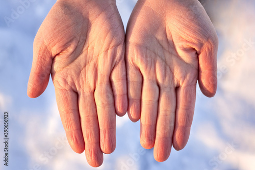 Dry female hands in winter on a background of snow. photo