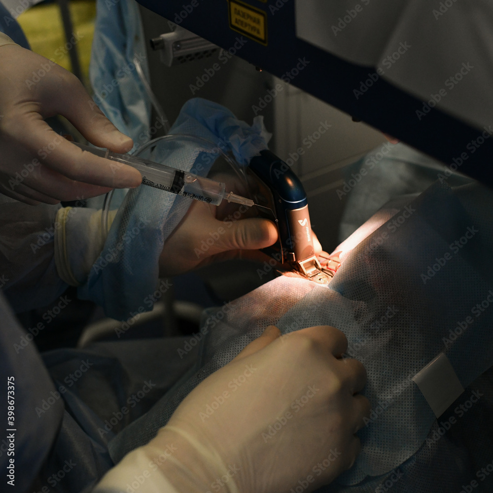 ophthalmologist doctor lenses vision eyes operation correction ...