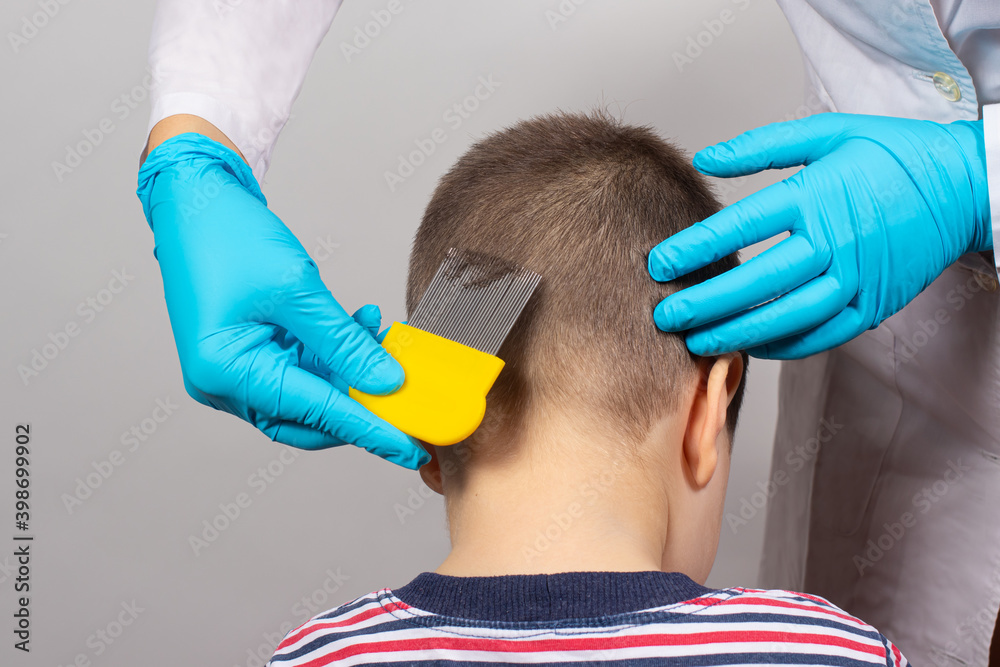 The doctor checks the presence of lice in a small child with the help