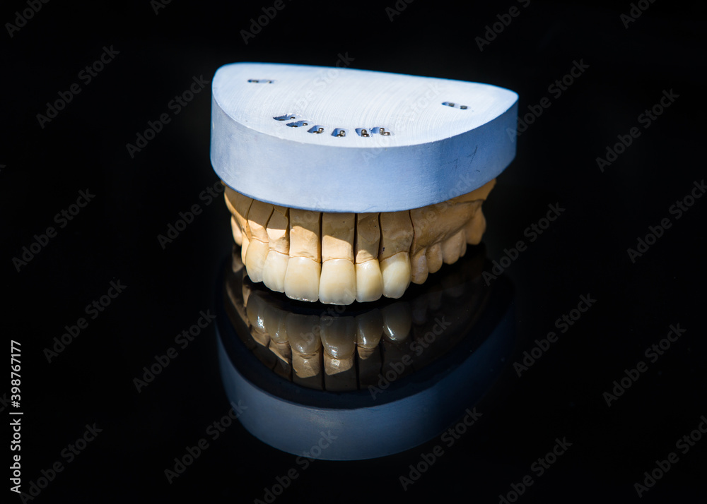 Ceramic teeth dental crowns model on black background.