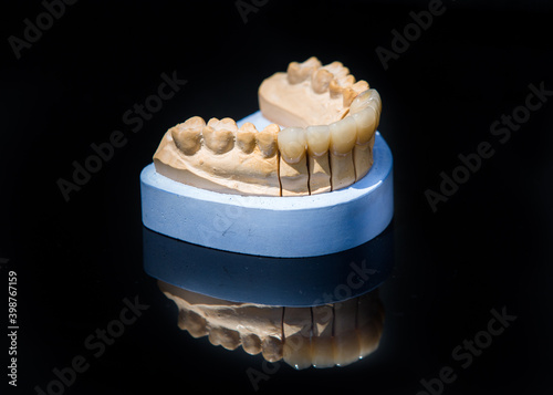 Obraz na płótnie Ceramic teeth dental crowns model on black background. w salonie
