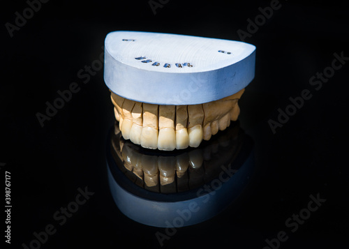Obraz na płótnie Ceramic teeth dental crowns model on black background. w salonie
