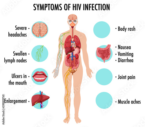 Symptoms of HIV infection infographic