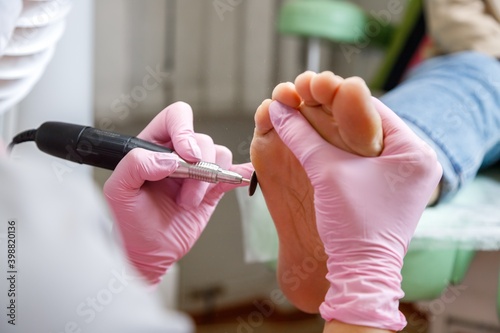 Women's feet and pedicure master. Professional hardware pedicure in a medical salon. Grinding rough skin on the foot with an abrasive disc. Visiting an orthopedic podiatrist.