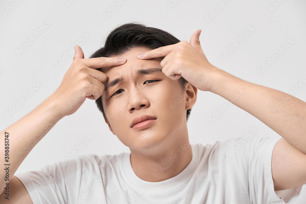young man caring about acne, men's skincare concept young man caring about acne, men's skincare concept