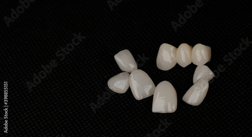dental laminate veneers, zirconia ceramic crowns photo