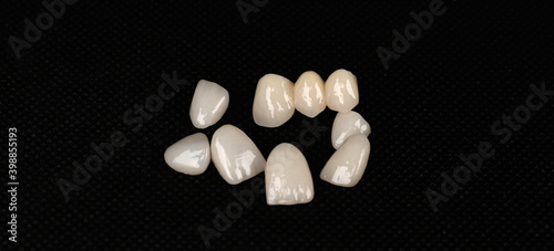 dental laminate veneers, zirconia ceramic crowns photo