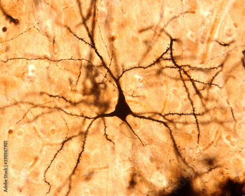 Pyramidal cell. Cerebral cortex photo