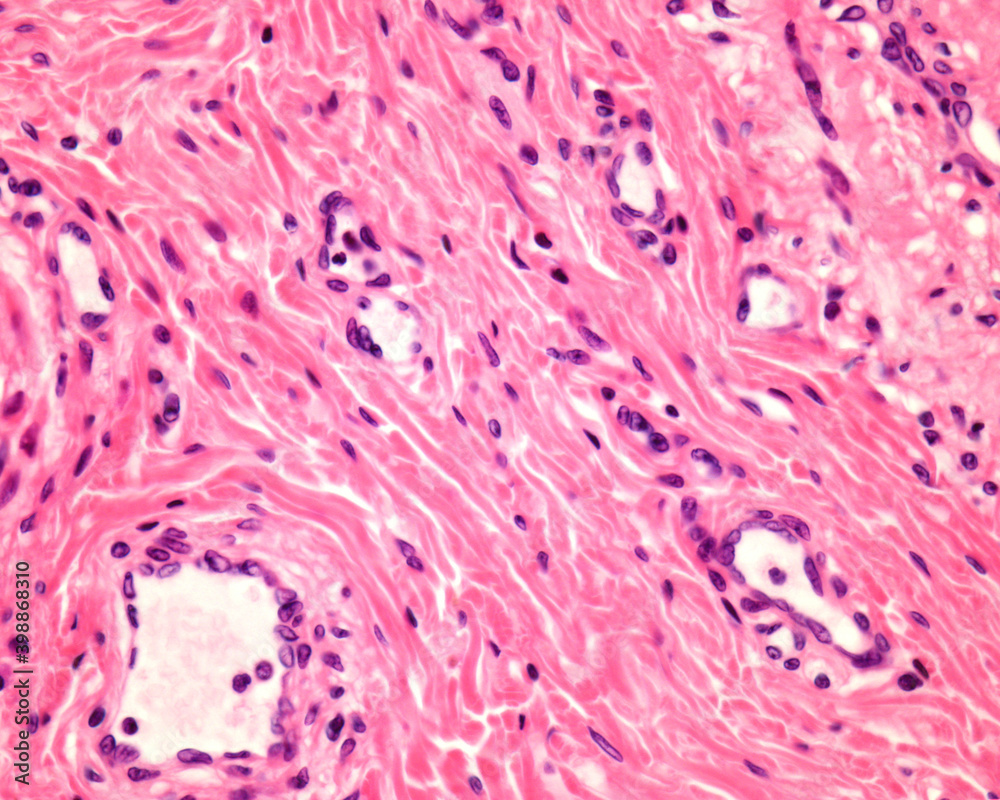Esophagus submucosa. Connective tissue
