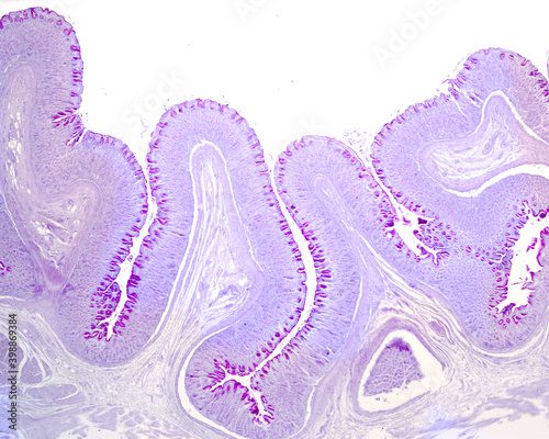 Gastric mucosa. PAS stain photo