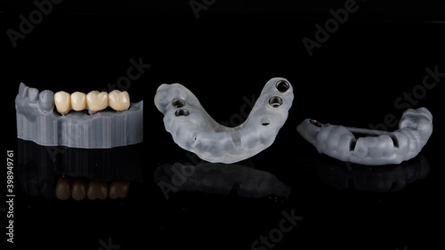 Принти на полотні dental kit for implantation and immediate loading, filmed against a black backgr