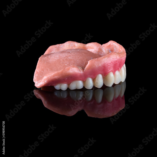 Complete maxillary denture – Wax-Up and Gingival Contouring