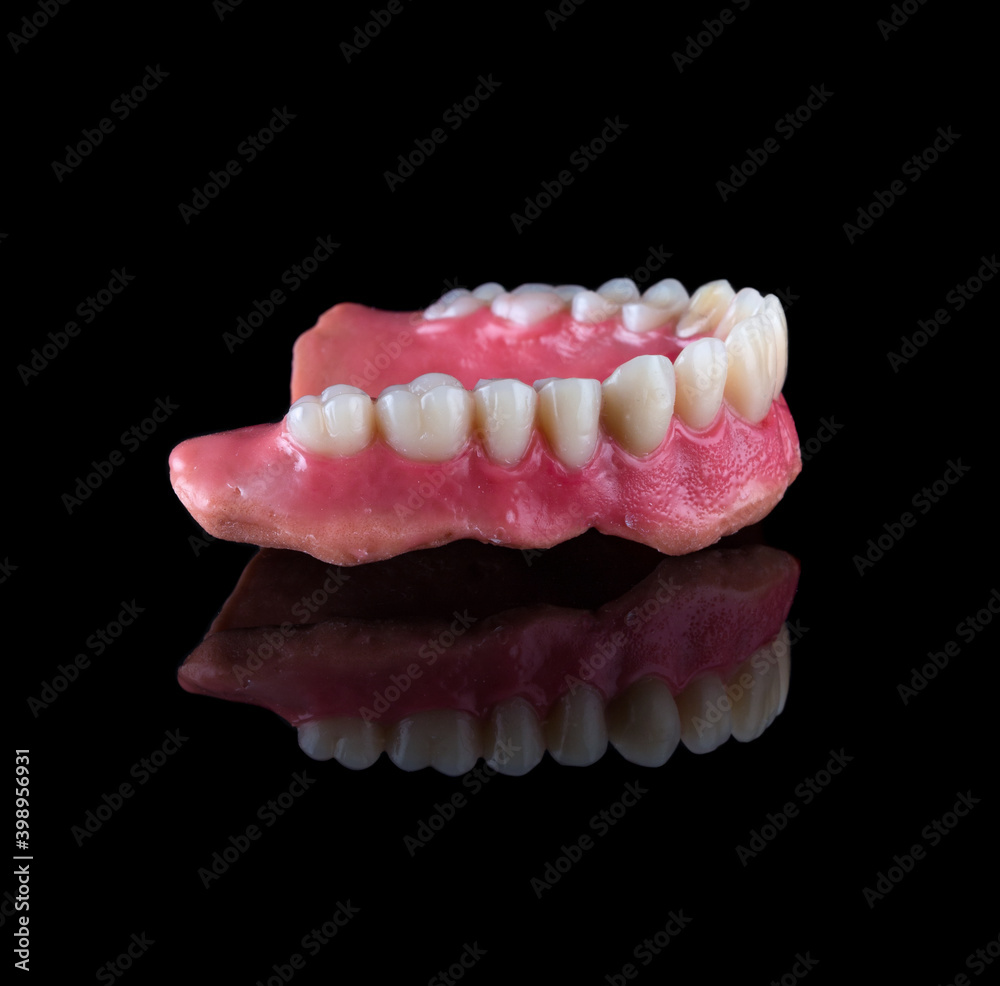 Complete maxillary denture – Wax-Up and Gingival Contouring Complete maxillary denture – Wax-Up and Gingival Contouring