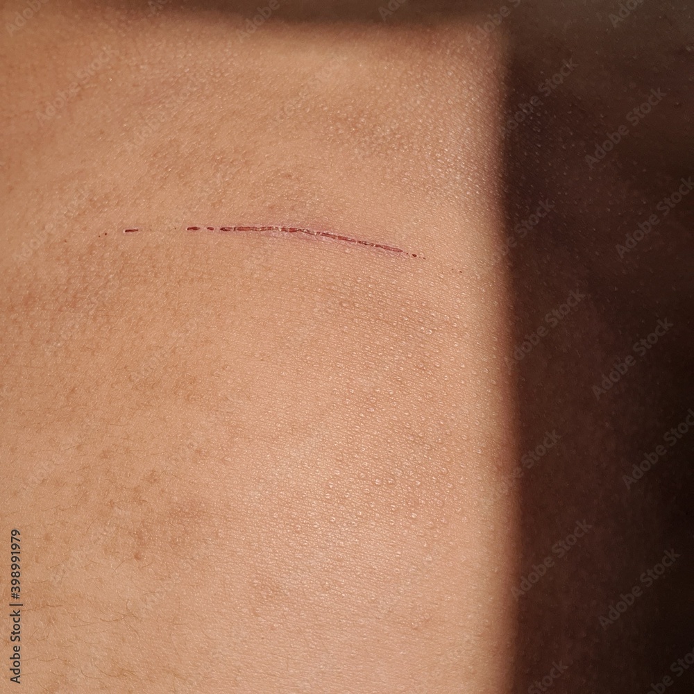 Fototapeta premium skin