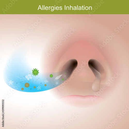 Allergies inhalation. Illustration show close up human nose from reaction the immune system response..