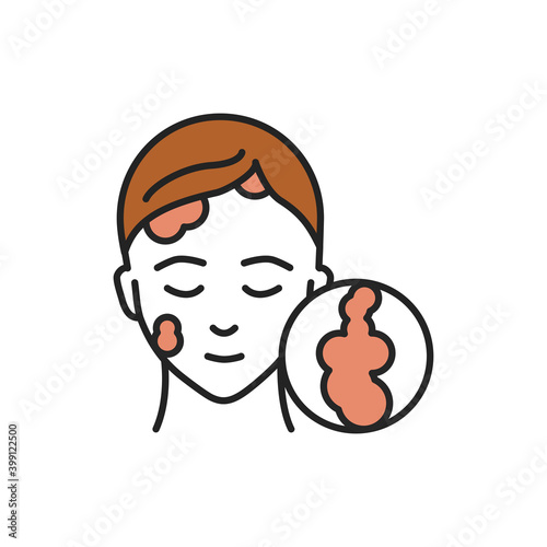 Seborrhoeic dermatitis line color icon. Sign for web page, mobile app